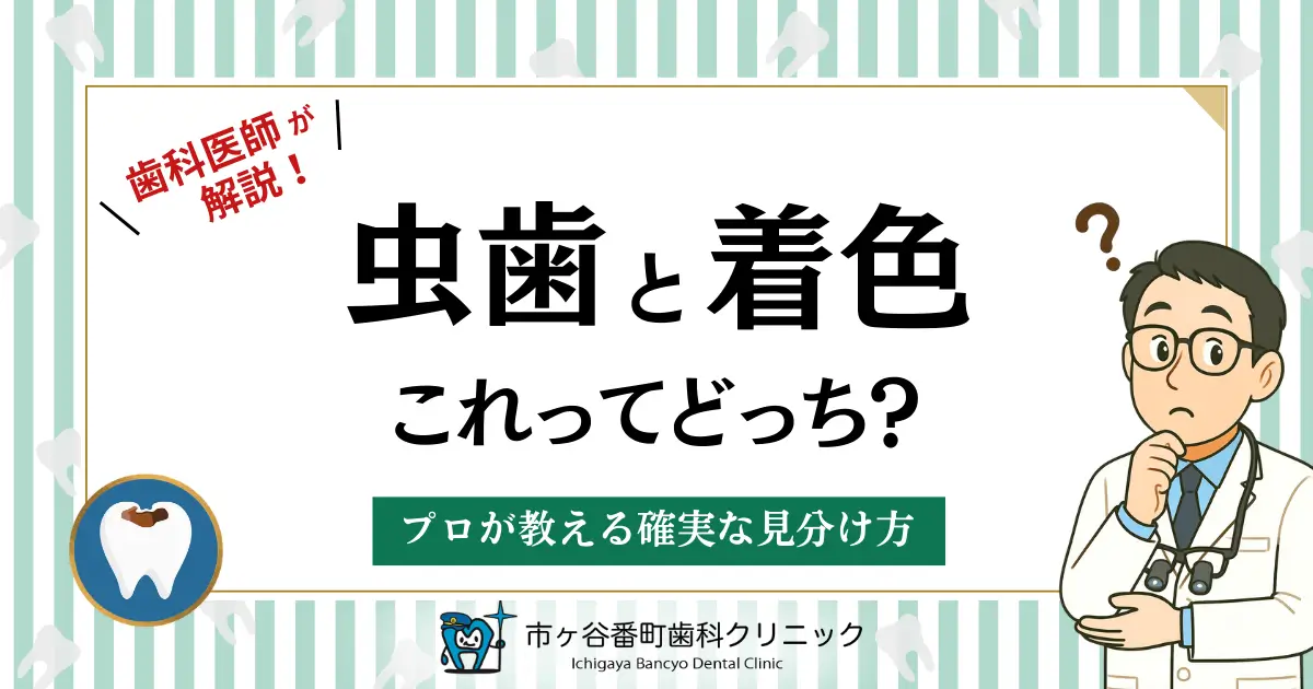 歯科医師が解説！虫歯と着色、これってどっち？プロが教える確実な見分け方