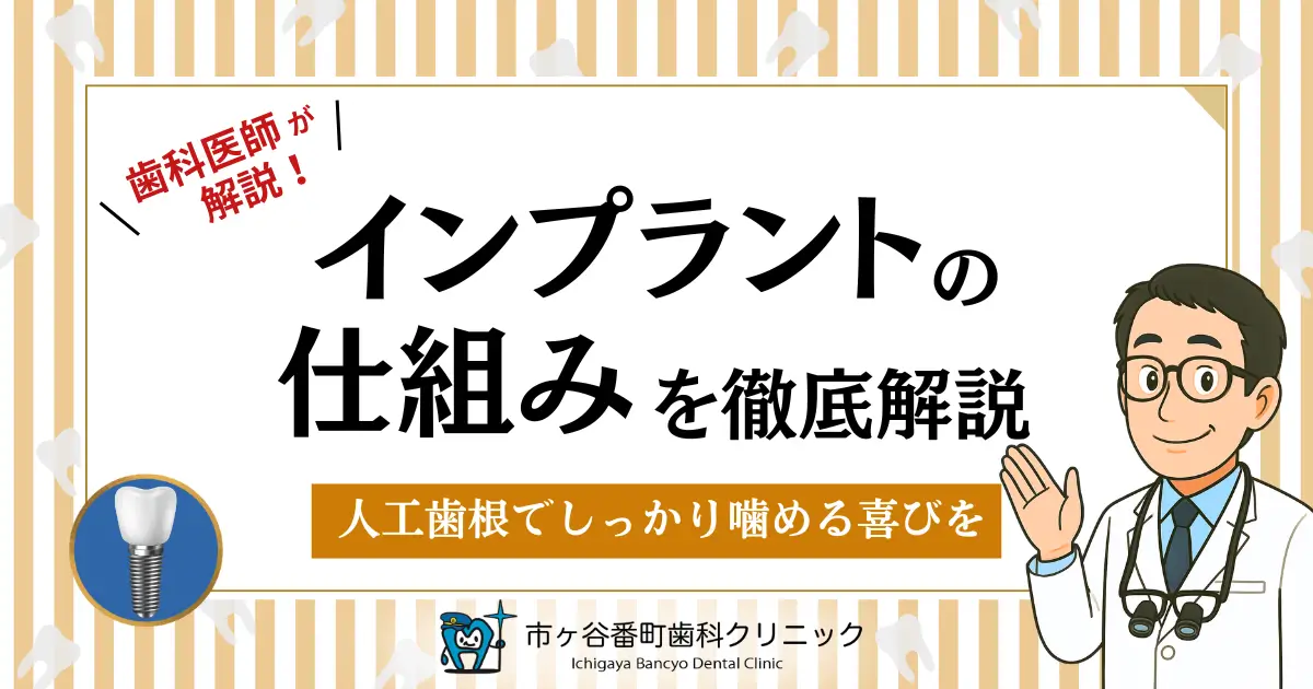 歯科医師が解説！インプラントの仕組みを徹底解説！人工歯根でしっかり噛める喜びを