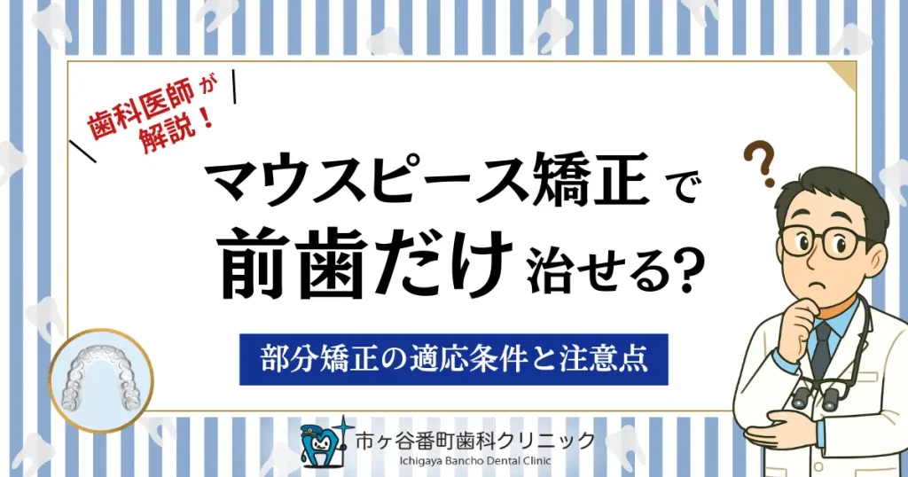 マウスピース矯正で前歯だけ治せる？部分矯正の適応条件と注意点