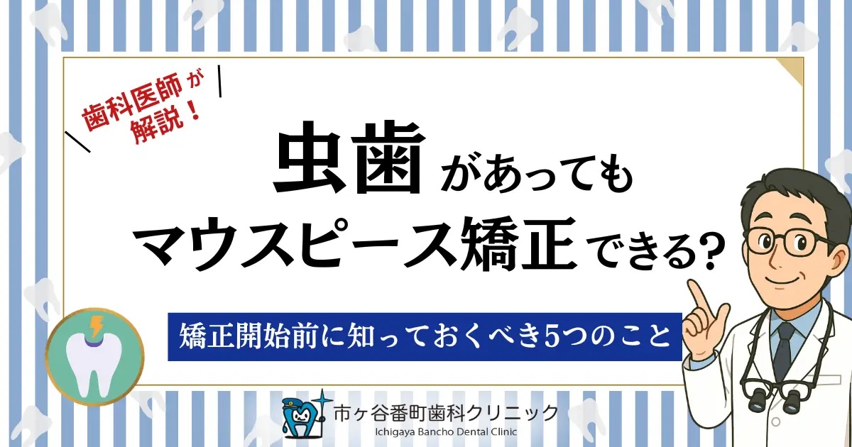 虫歯があってもマウスピース矯正はできる？矯正開始前に知っておくべき5つのこと