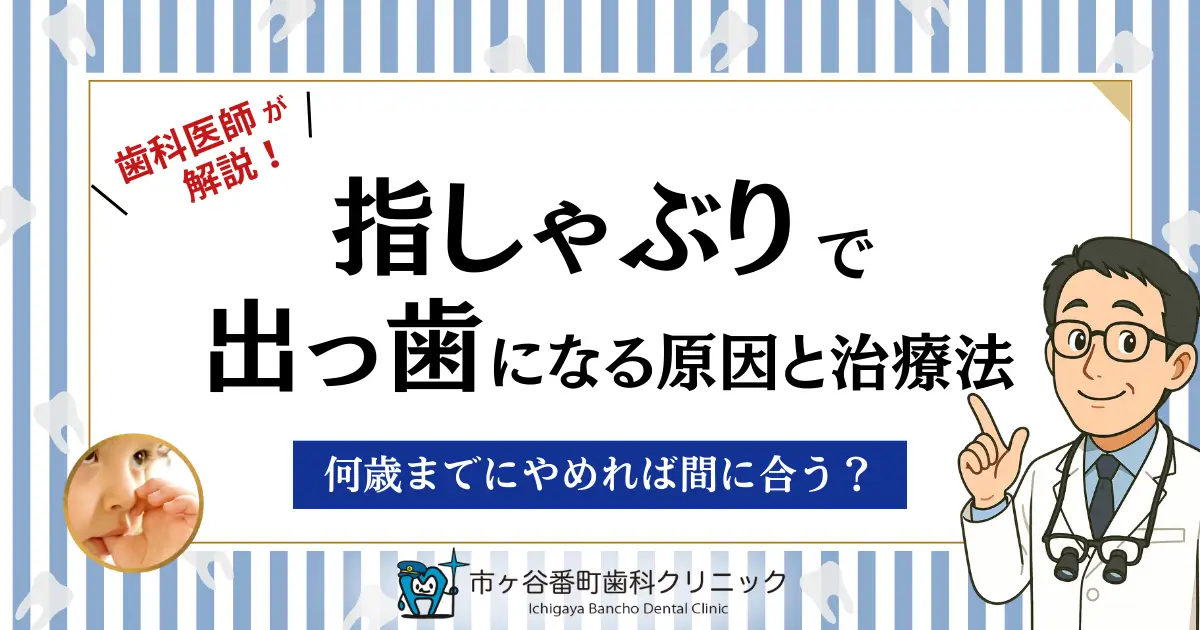 指しゃぶりで出っ歯になる原因と治療法｜何歳までにやめれば間に合う？