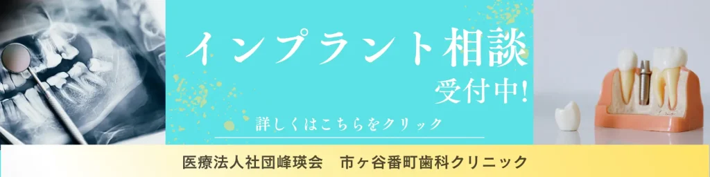 市ヶ谷番町歯科クリニックはインプラント相談予約受付中