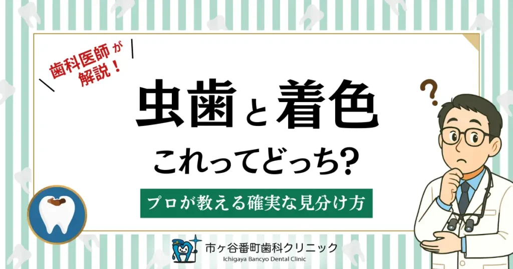 虫歯と着色、これってどっち？プロが教える確実な見分け方