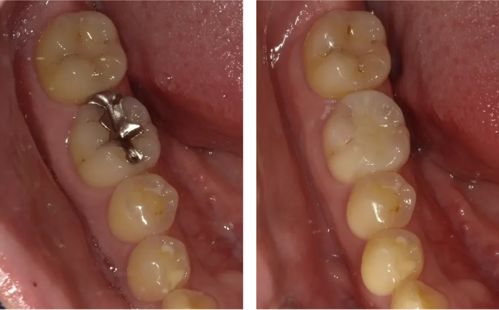 aesthetic dentistry 02