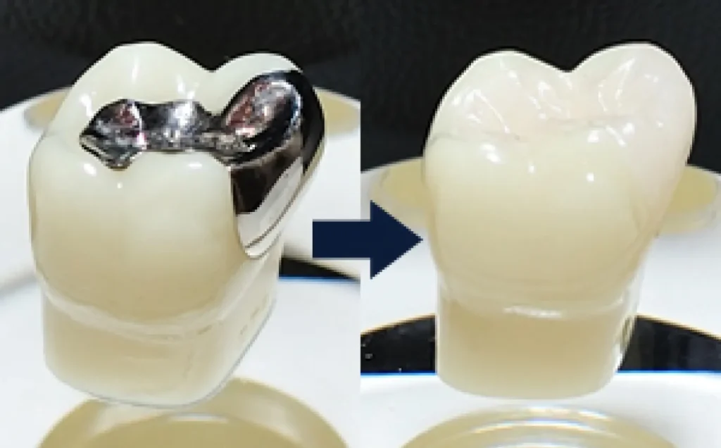 aesthetic dentistry 03