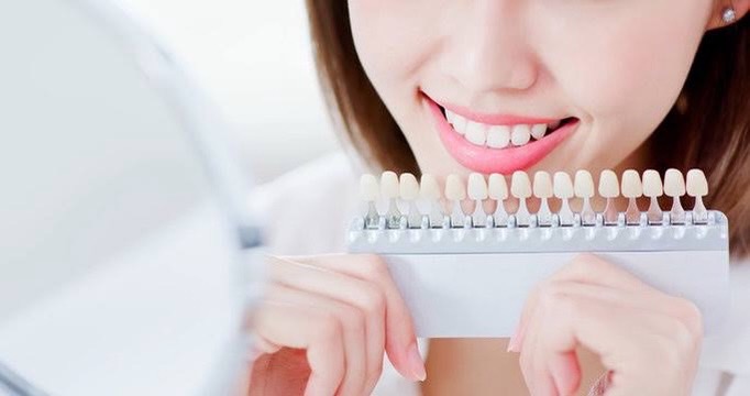 ホワイトニング　白さが持続する人しない人